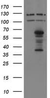 Monoclonal Mouse anti-Human SENP2 Antibody (clone OTI6F1, IHC, IF, WB)