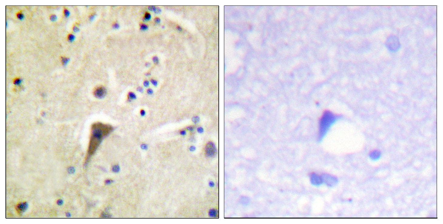 FAK / Focal Adhesion Kinase Antibody (phospho-Tyr397)