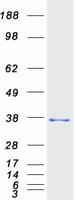 Human HADH Protein (Recombinant Myc-DDK (Flag))