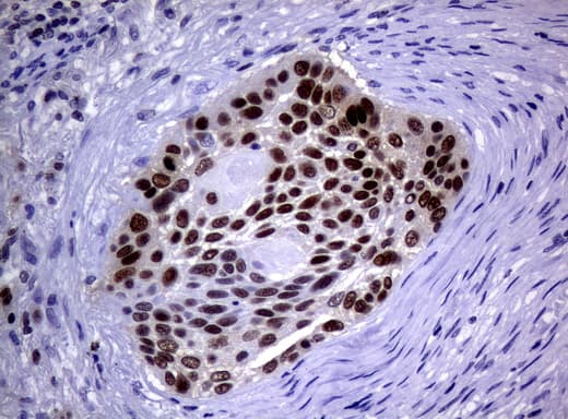 MGMT Antibody (clone UMAB52, Carrier-free)