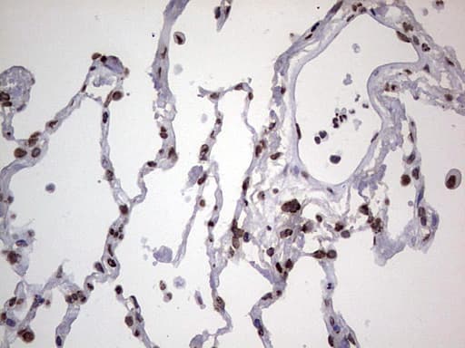 HNRNPL / hnRNP L Antibody (aa270-502, clone OTI9F11)