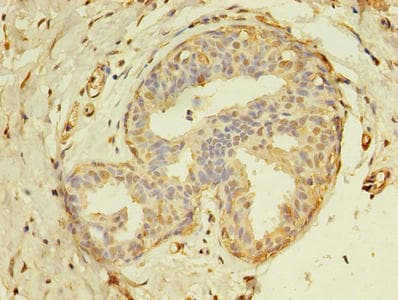 Polyclonal Rabbit anti-Human THRA / THR Alpha Antibody (aa1-490, IHC, WB)