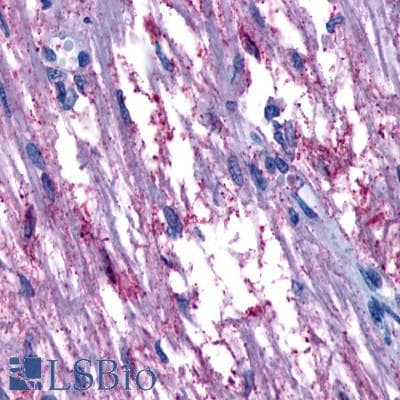 PathPlus™ Polyclonal Rabbit anti-Human GPR161 Antibody (C-Terminus, IHC)