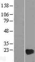 CRYGD / CCP Protein (Over-Expression Lysate Myc-DDK (Flag))
