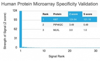 MKI67 / Ki67 Antibody (clone MKI67/2462)