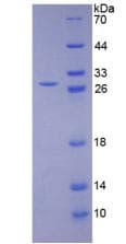 Human LOXL1 Protein (Recombinant His)