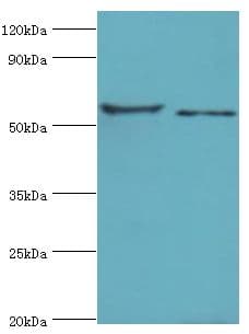 Polyclonal Rabbit anti-Human CNDP1 Antibody (aa1-280, IHC, WB)