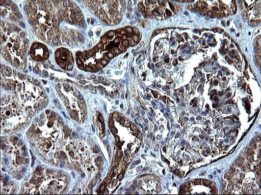 Monoclonal Mouse anti-Human PDCD6IP / ALIX Antibody (clone OTI1A4, IHC, WB)