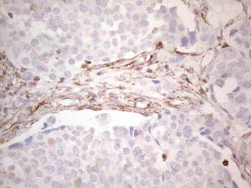 Peripherin Antibody (clone UMAB202, Carrier-free)