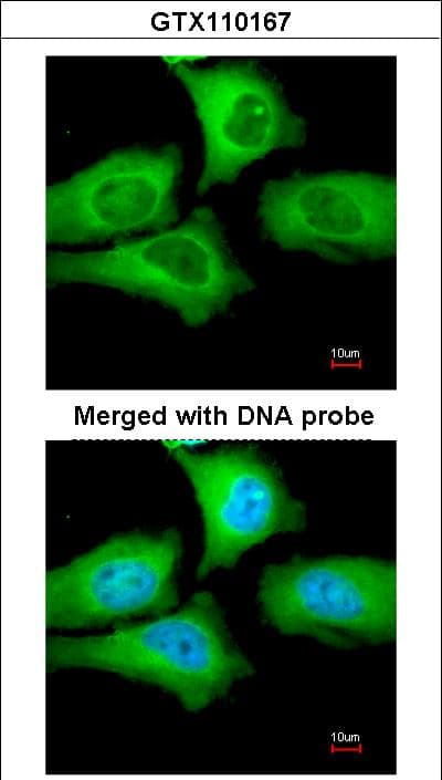 IHC-plus™ Polyclonal Rabbit anti-Human CCT5 / TCP1 Epsilon Antibody (aa89-338, IHC, WB)