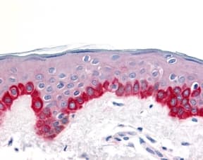 APAF1 / APAF-1 Antibody