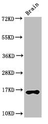 Polyclonal Rabbit anti-Human HIST1H3A Antibody (IHC, IF, WB)