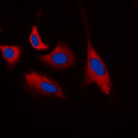 CDK5 Antibody (phospho-Tyr15)