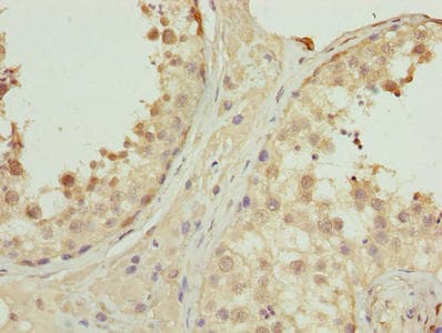 PNMA1 / MA1 Antibody