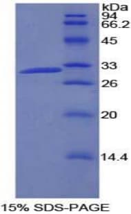Rat PIK3C2B Protein (Recombinant His-T7)