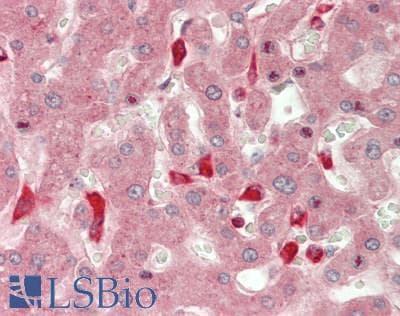 CHI3L1 / YKL-40 Antibody (aa112-377)