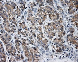 Monoclonal Mouse anti-Human LIPG / Endothelial Lipase Antibody (clone OTI6B11, IHC, IF, WB)
