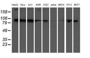 KIF2C / MCAK Antibody (clone OTI1C5)