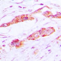 Polyclonal Rabbit anti-Human CLIC4 Antibody (N-Terminus, IHC, WB)
