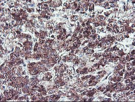 Monoclonal Mouse anti-Human NLN / Neurolysin Antibody (clone OTI3H4, IHC, WB)