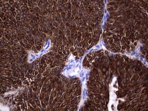 Monoclonal Mouse anti-Human KRT19 / CK19 / Cytokeratin 19 Antibody (clone OTI6E8, aa240-390, IHC)