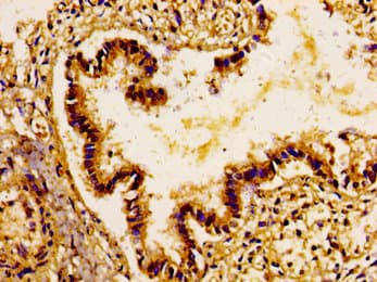 Polyclonal Rabbit anti-Human GPR48 / LGR4 Antibody (IHC)