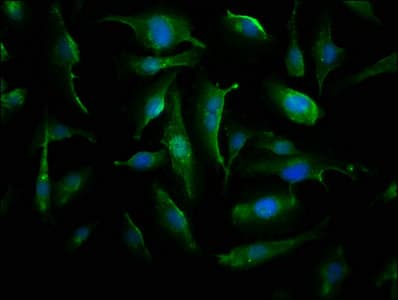 CRYAB / Alpha B Crystallin Antibody (aa1-175)