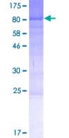 Human KIAA1539 Protein (Recombinant GST)