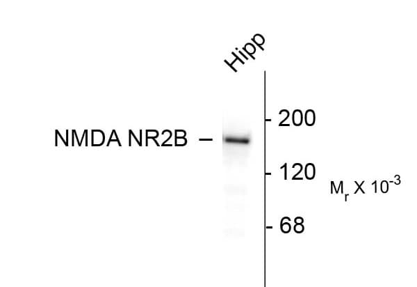 GRIN2B / NMDAR2B / NR2B Antibody (C-Terminus)