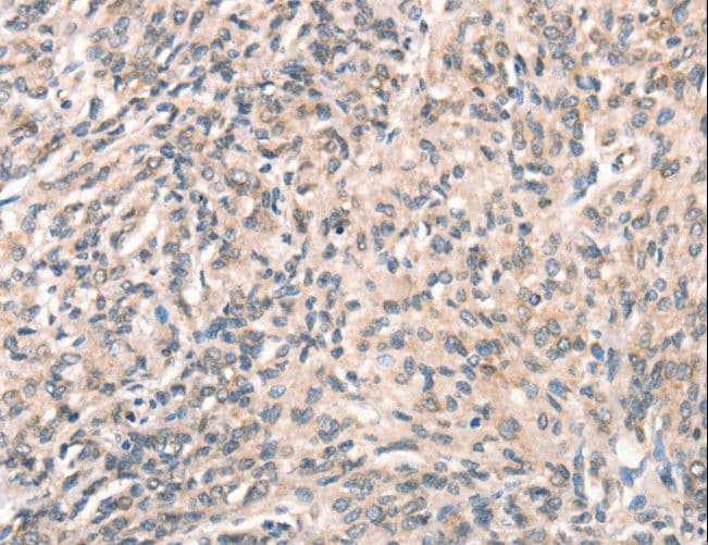 DECR1 Antibody