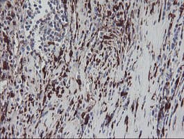 F13A1 / Factor XIIIa Antibody (clone OTI3F1)