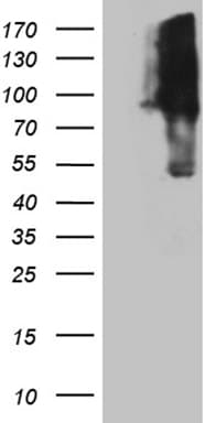 KIF9 Antibody (aa430-790, clone OTI1A2)