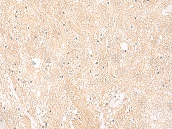 EMC1 Antibody