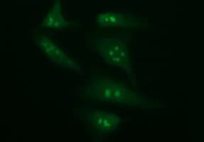 CD45 / LCA Antibody (clone OTI3C8)