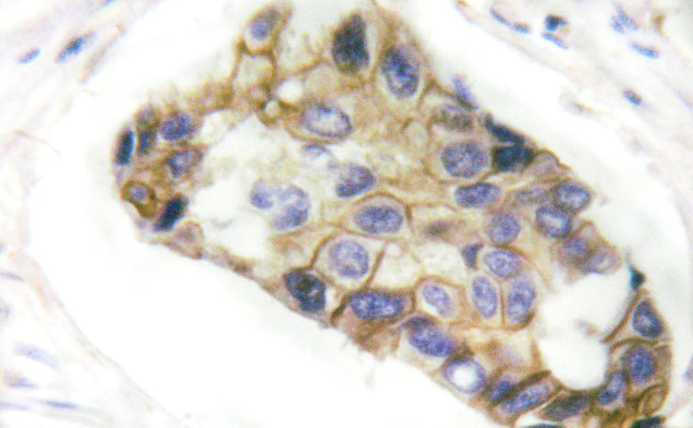 RHOA Antibody