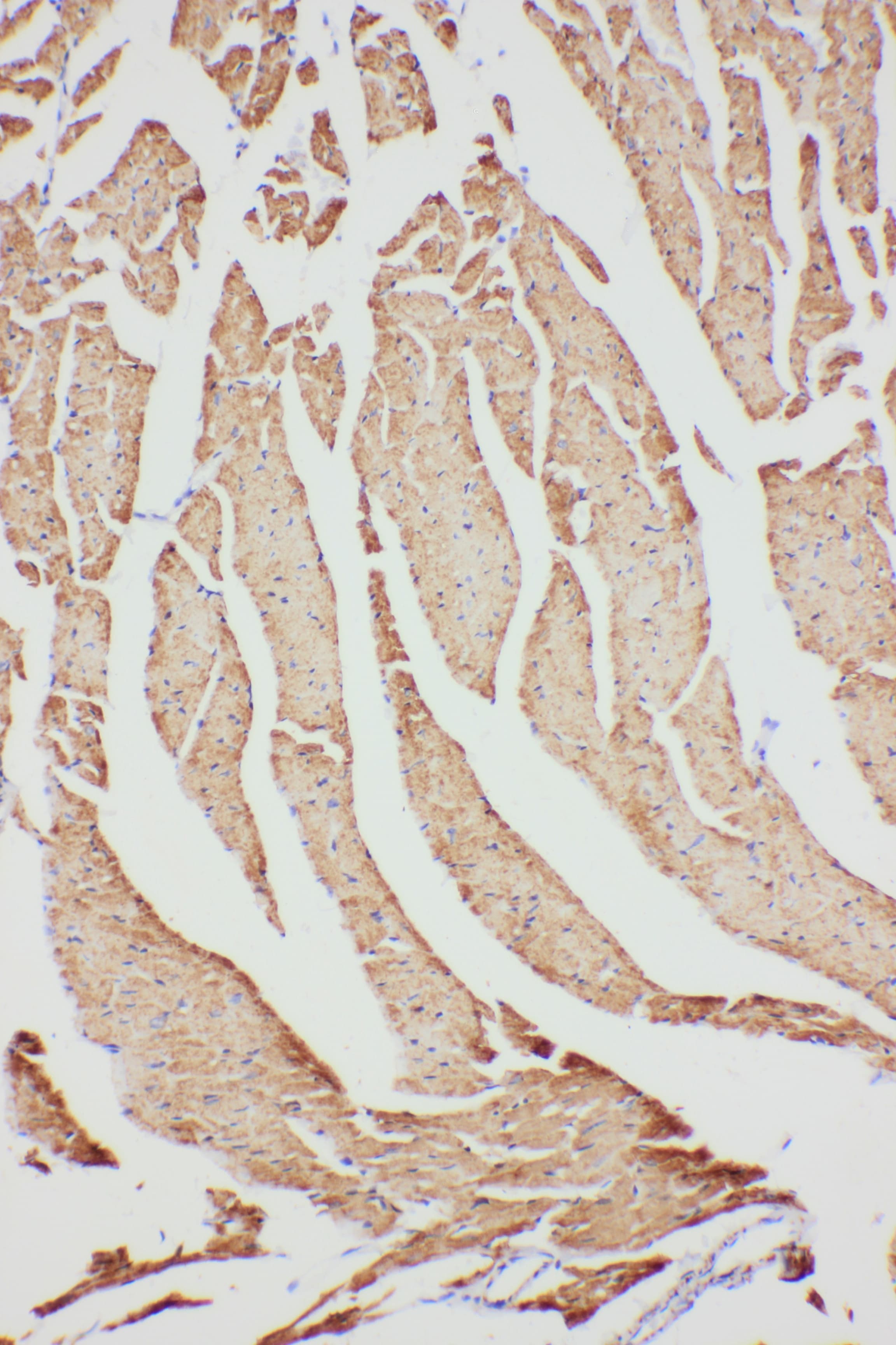 VDAC1 / PORIN Antibody (aa163-178)