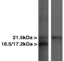 IHC-plus™ MBP / Myelin Basic Protein Antibody (clone 7D2)