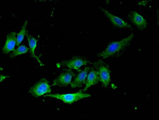 RAB5A / RAB5 Antibody