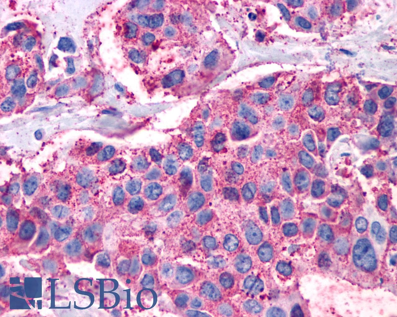 IHC-plus™ VIPR1 Antibody (Cytoplasmic Domain)
