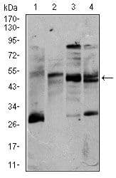 Monoclonal Mouse anti-Human CD5 Antibody (clone 6A11, Amino Acid: 27-233, WB)
