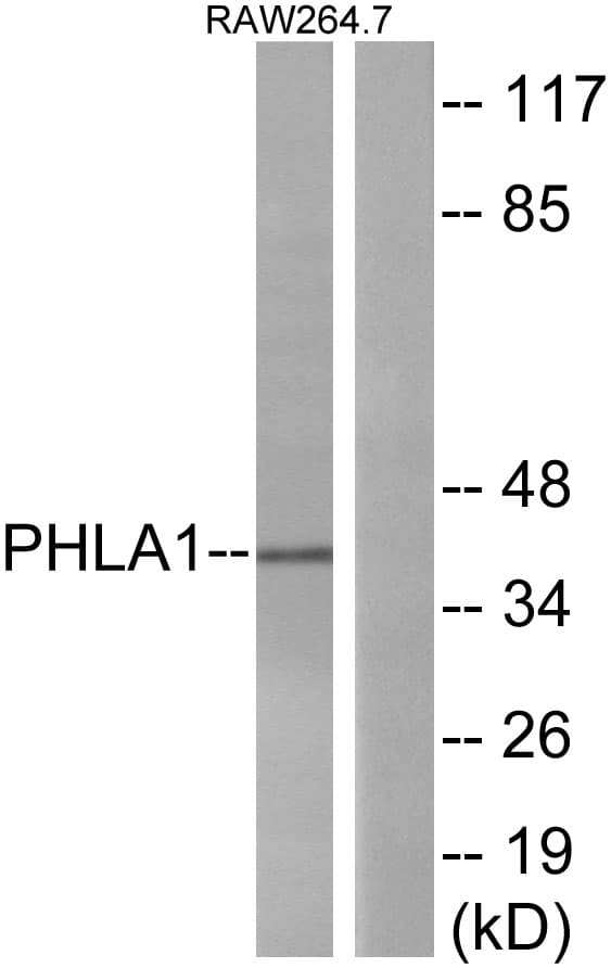 PHLDA1 Antibody (aa271-320)