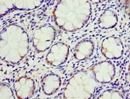 Polyclonal Rabbit anti-Human CD66d / CEACAM3 Antibody (aa1-135, IHC)