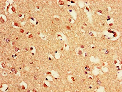 PAK3 Antibody