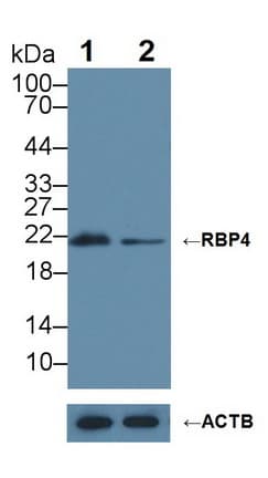 RBP4 Antibody (aa1-183)