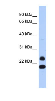 NEUROG2 / NGN2 / Neurogenin 2 Antibody (aa35-84)