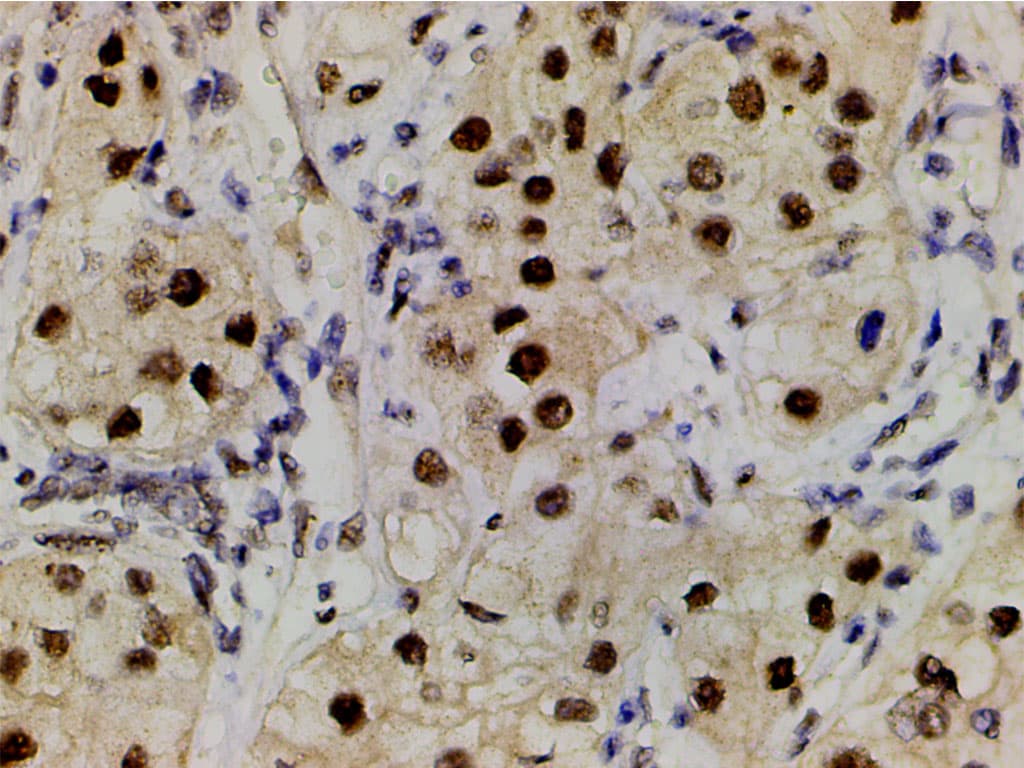 LIMK1 / LIMK Antibody (phospho-Thr508)
