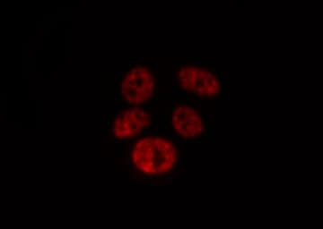 MYC / c-Myc Antibody
