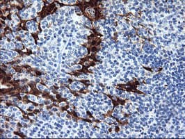 Monoclonal Mouse anti-Human SERPINB2 / PAI-2 Antibody (clone OTI3H1, IHC, WB)