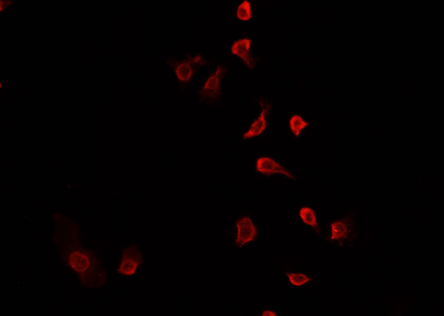 MBD1 Antibody