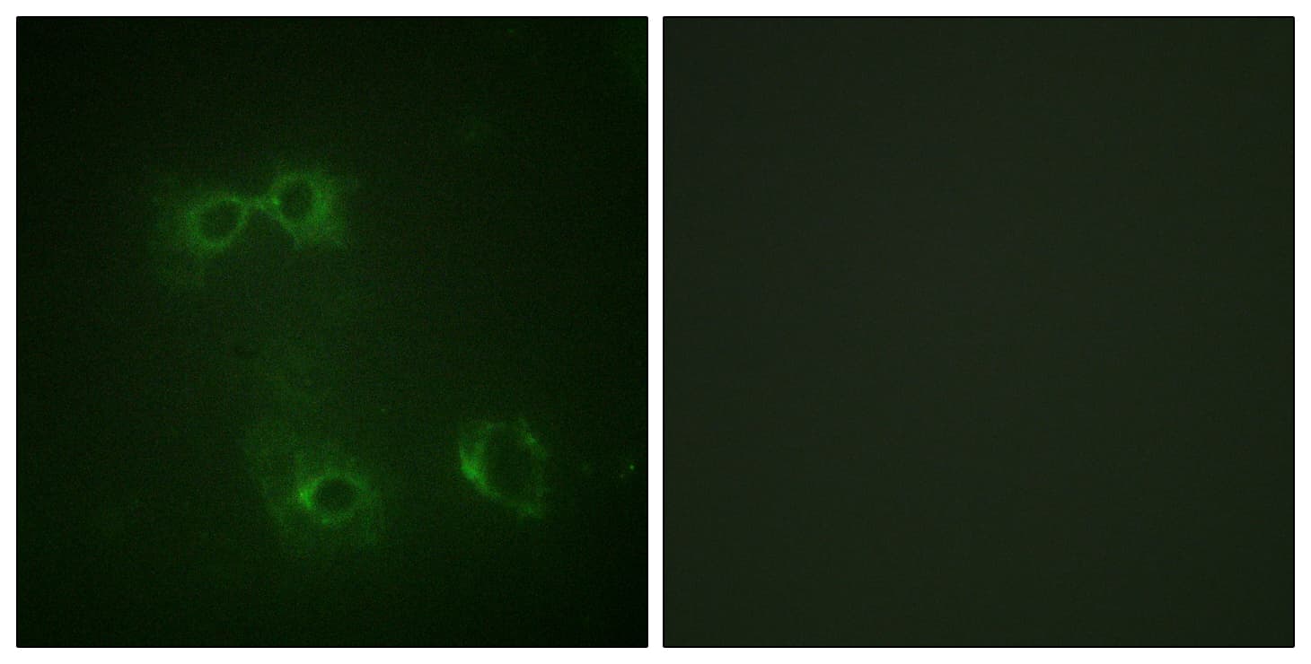 CD95 / FAS Antibody (phospho-Tyr291)